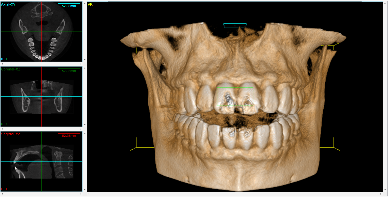 Cone Beam 3D Imaging  Plainville, MA , 